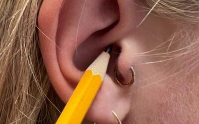Migrænepiercing